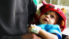 Kinder sterben an Hunger im Jemen.